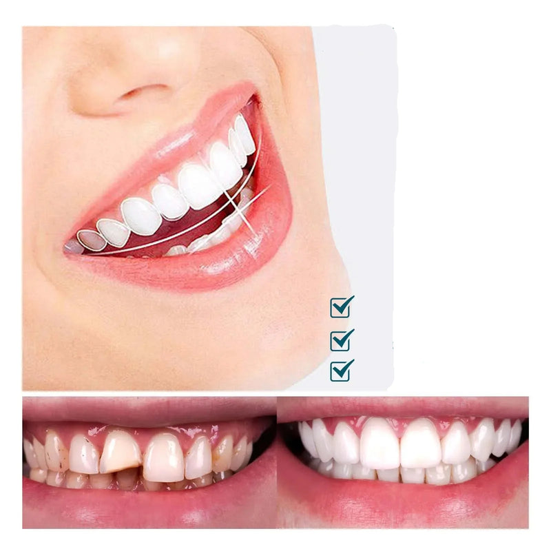 Facetas Dentárias Naturais Removíveis 2 por 1 | SmileFix Pro [Leve2 e pague 1]